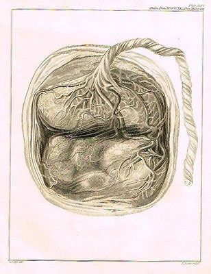 PLACENTA OF A MONKEY from  Palmer's "Works of John Hunter"-1837