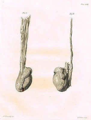 TESTICALS WITH SPERMATIC - from Palmer's "Works of John Hunter"-1837