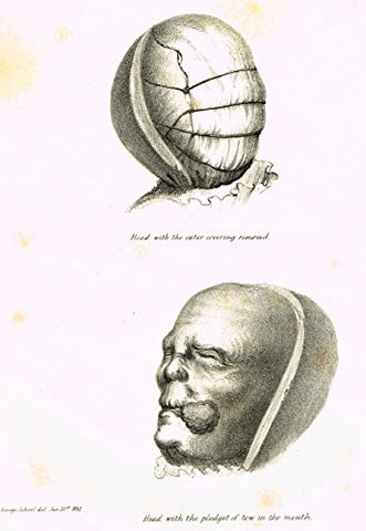 Archaeologia's Antiquity - HEAD WITH THE PLEDGET OF TOW IN THE MOUTH - Engraving - 1852