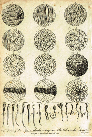 Antique Medical Print - "VIEW OF THE ANIMALCULAE PARTICLES IN THE SEMEN" - Copper Engraving - 1796