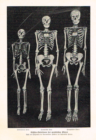 Meyers' Lexicon - "THREE SKELTONS"  - Lithograph - c1910
